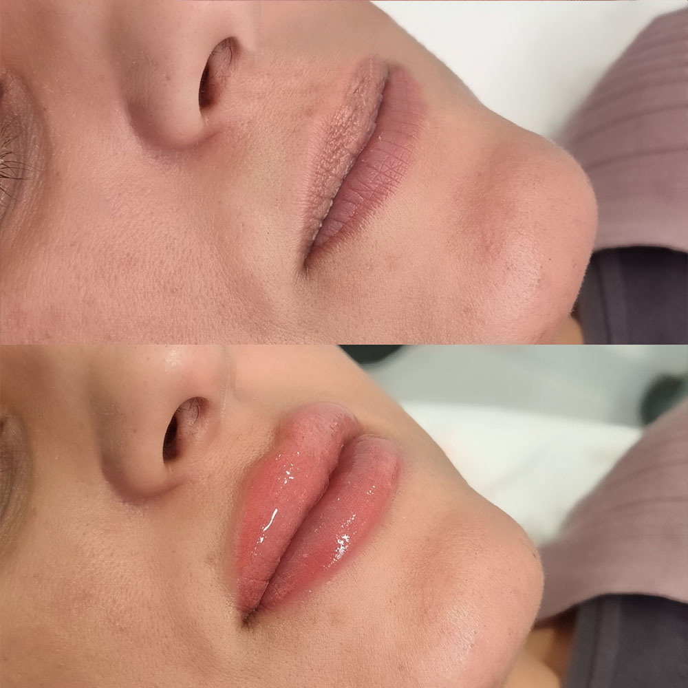 Buze înainte și după lip blush